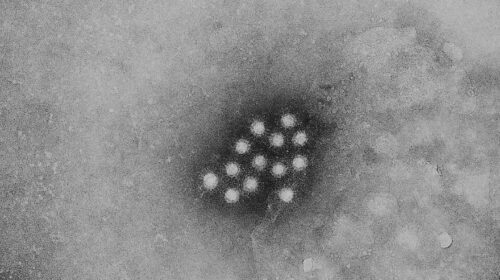 Hepatitis-A-Virus