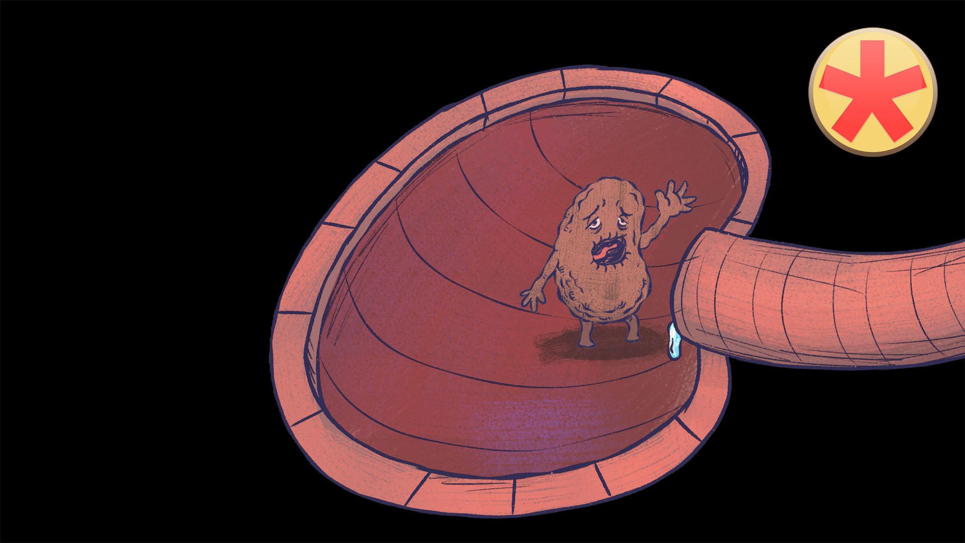 AHT 3: Nierenarterienstenose Medizin lernen mit den Eselsbrücken von Meditricks.de