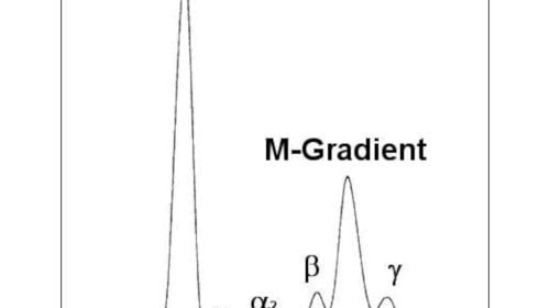 M-Gradient