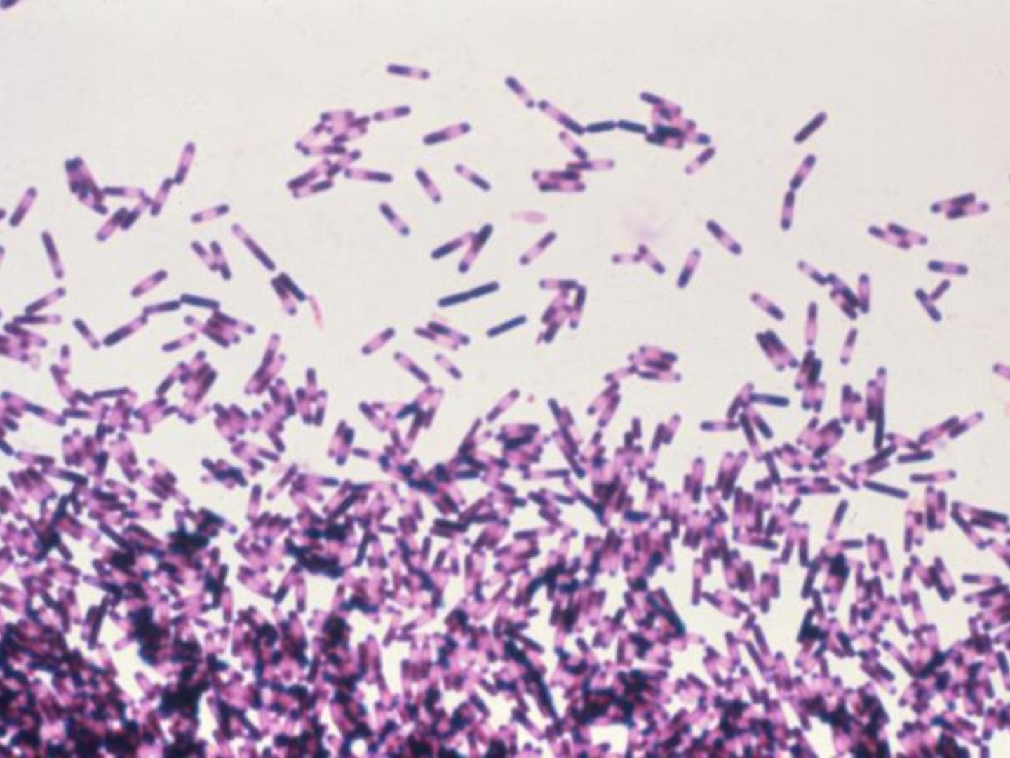 Clostridioides difficile