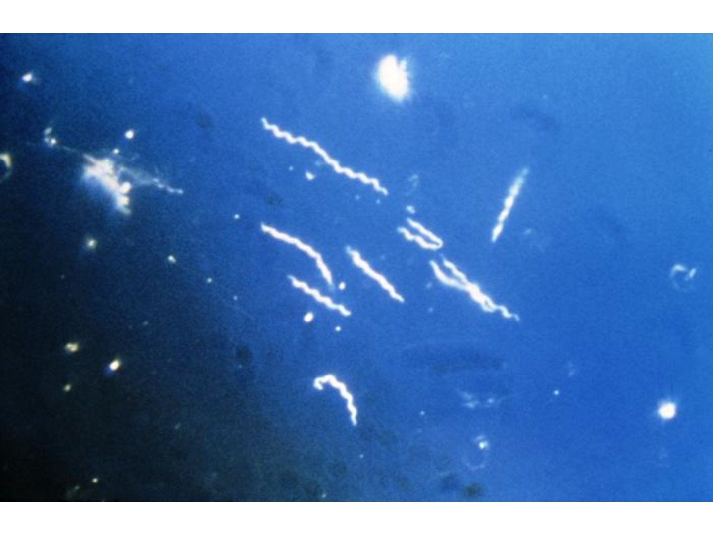 Borrelia burgdorferi