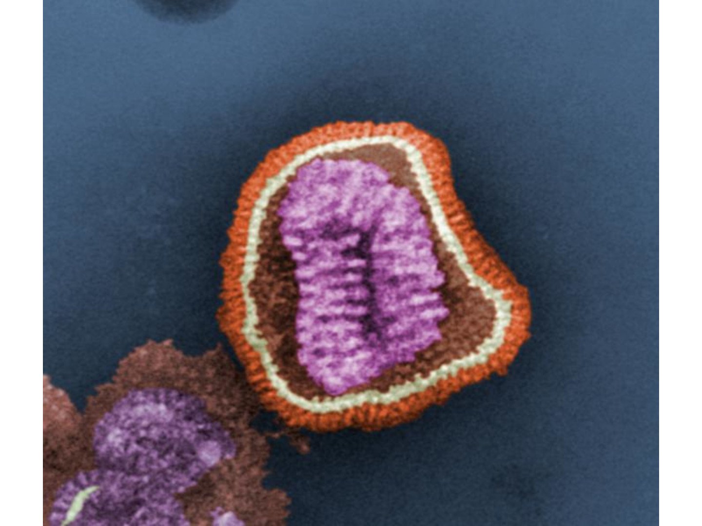 Influenzavirus im EM