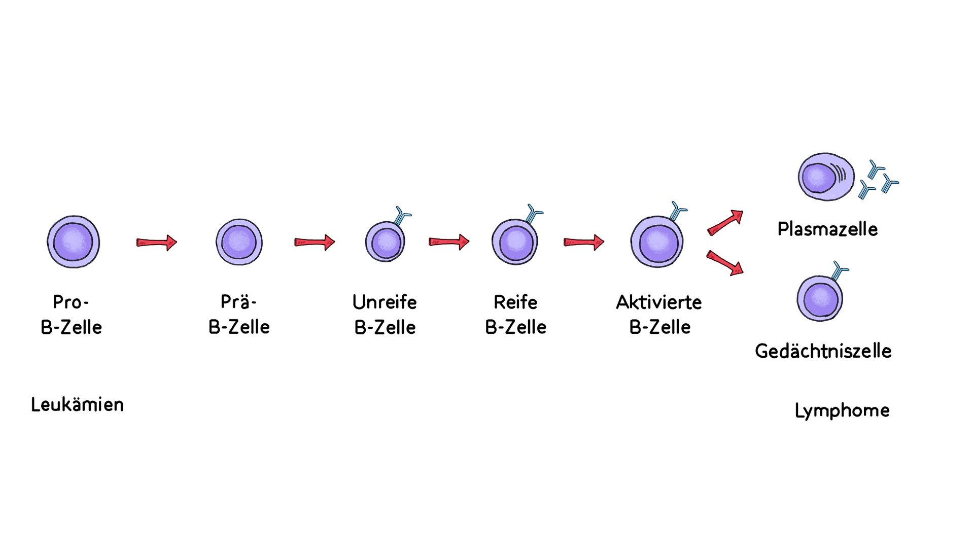 Schema Leukämie vs Lymphom