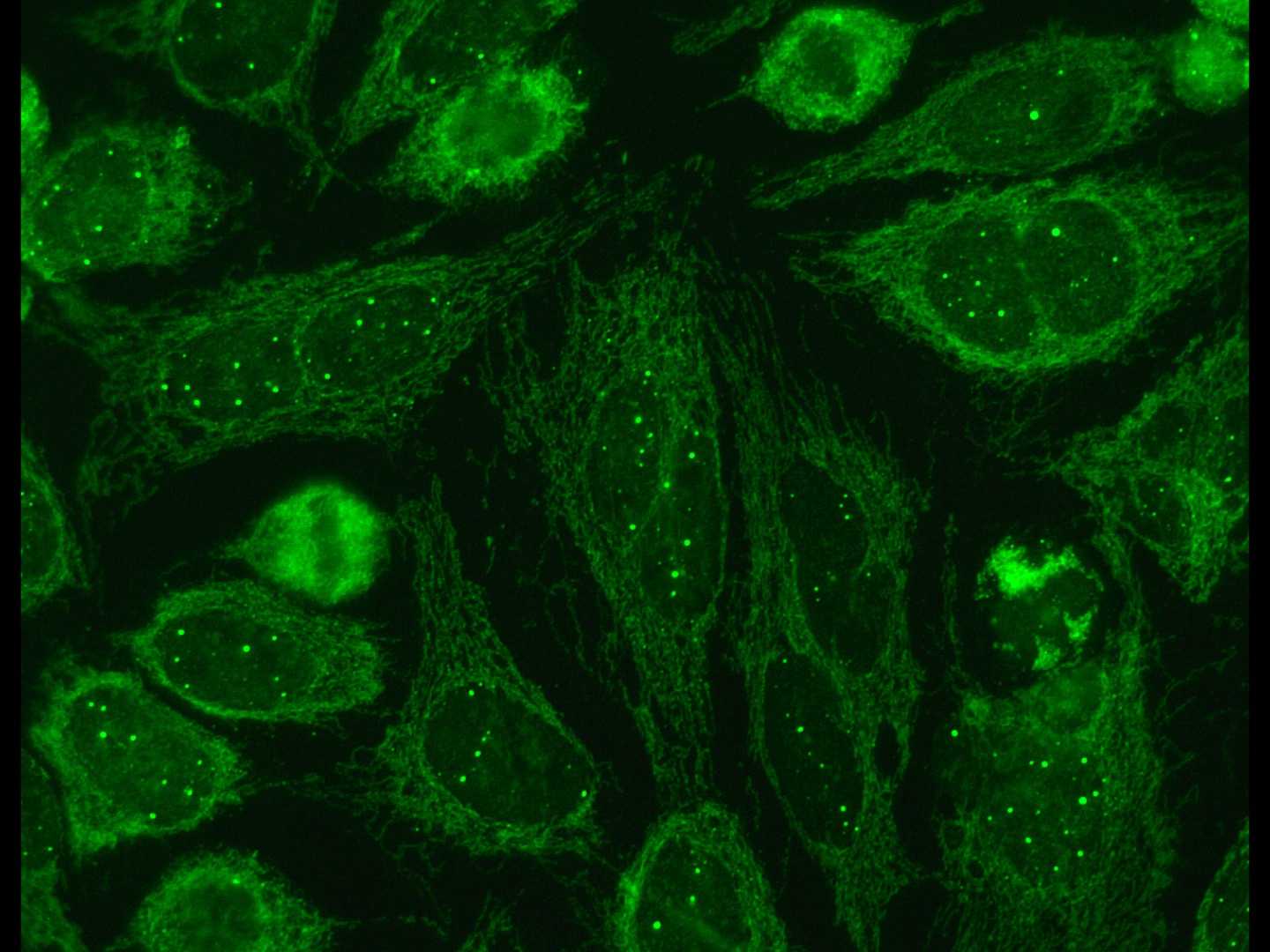 Immunfluoreszenz-Färbung
