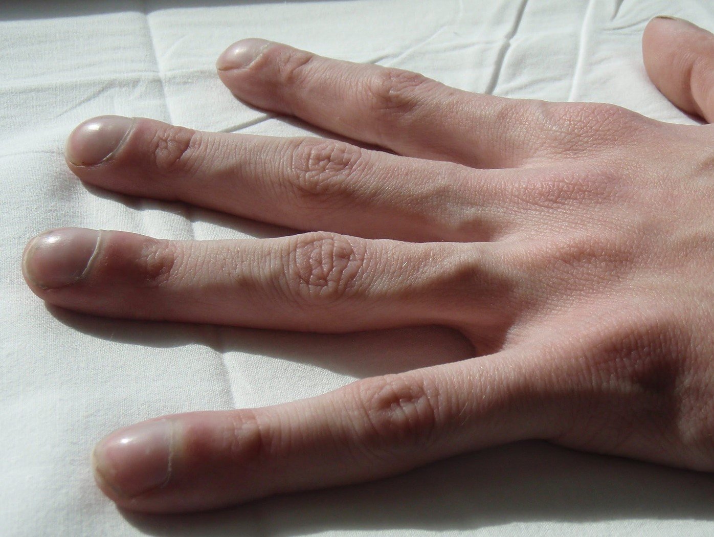 Trommelschlägelfinger