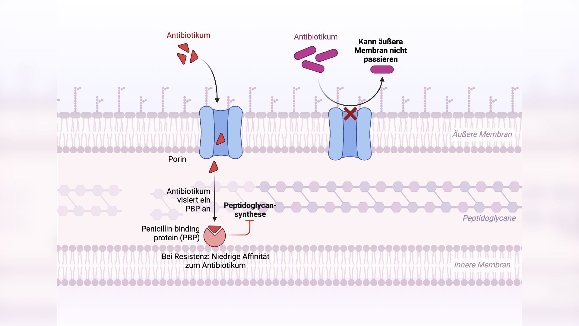 Antibiotikaresistenz