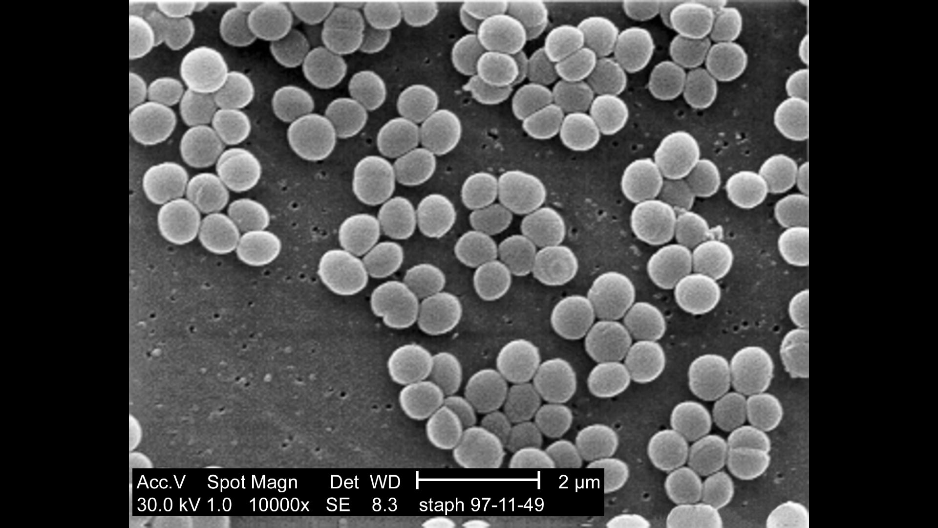 Elektronenmikroskopie: Staphylococcus aureus