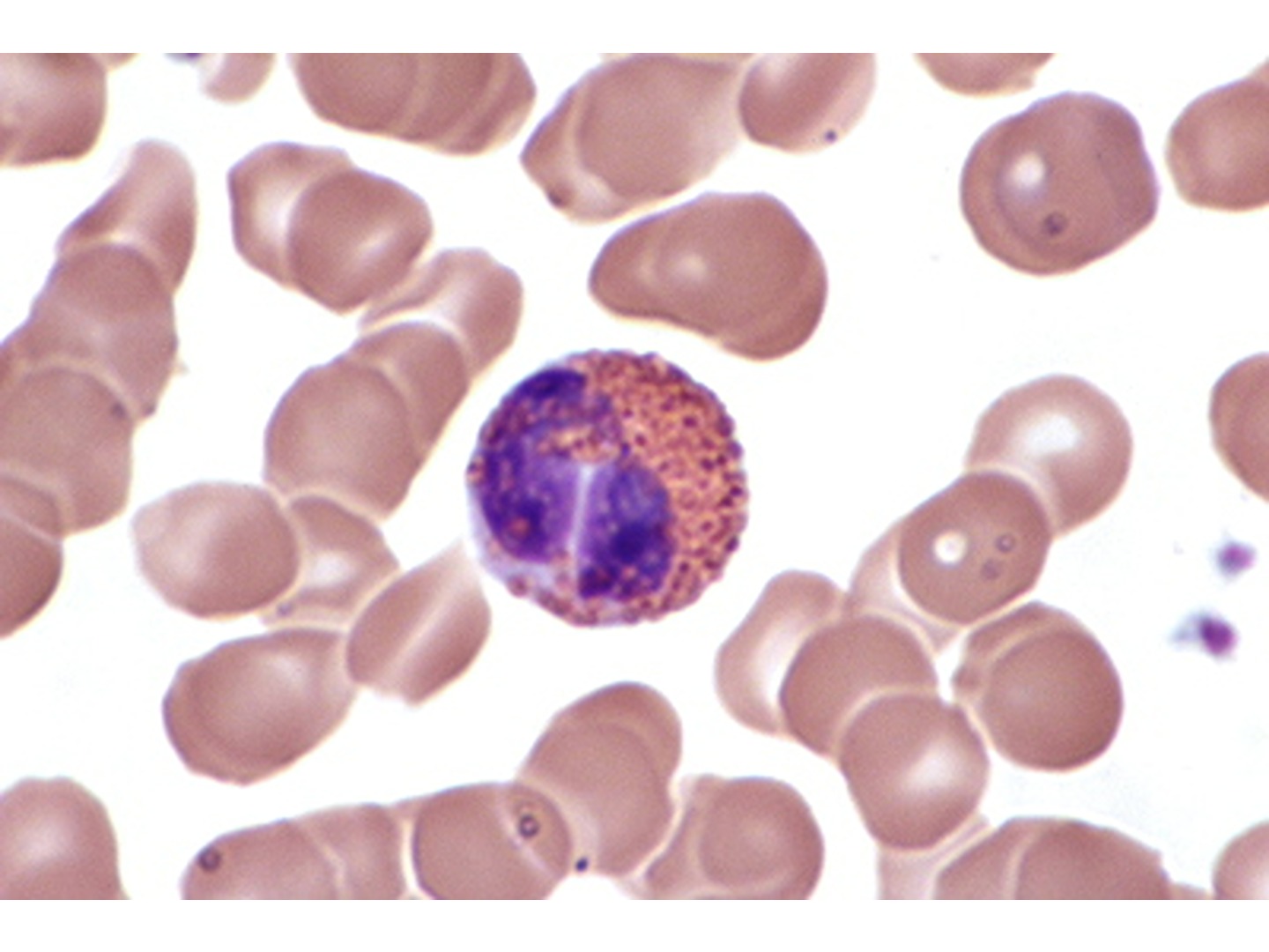 Eosinophiler