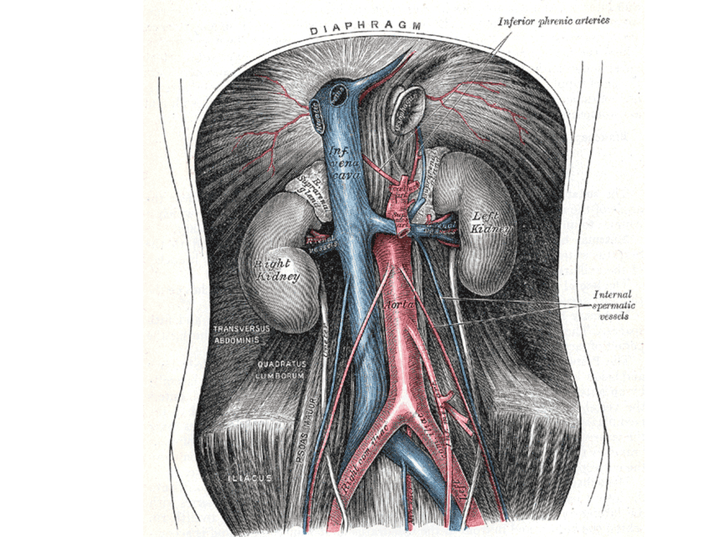 V. renalis sinistra überkreuzt die Aorta