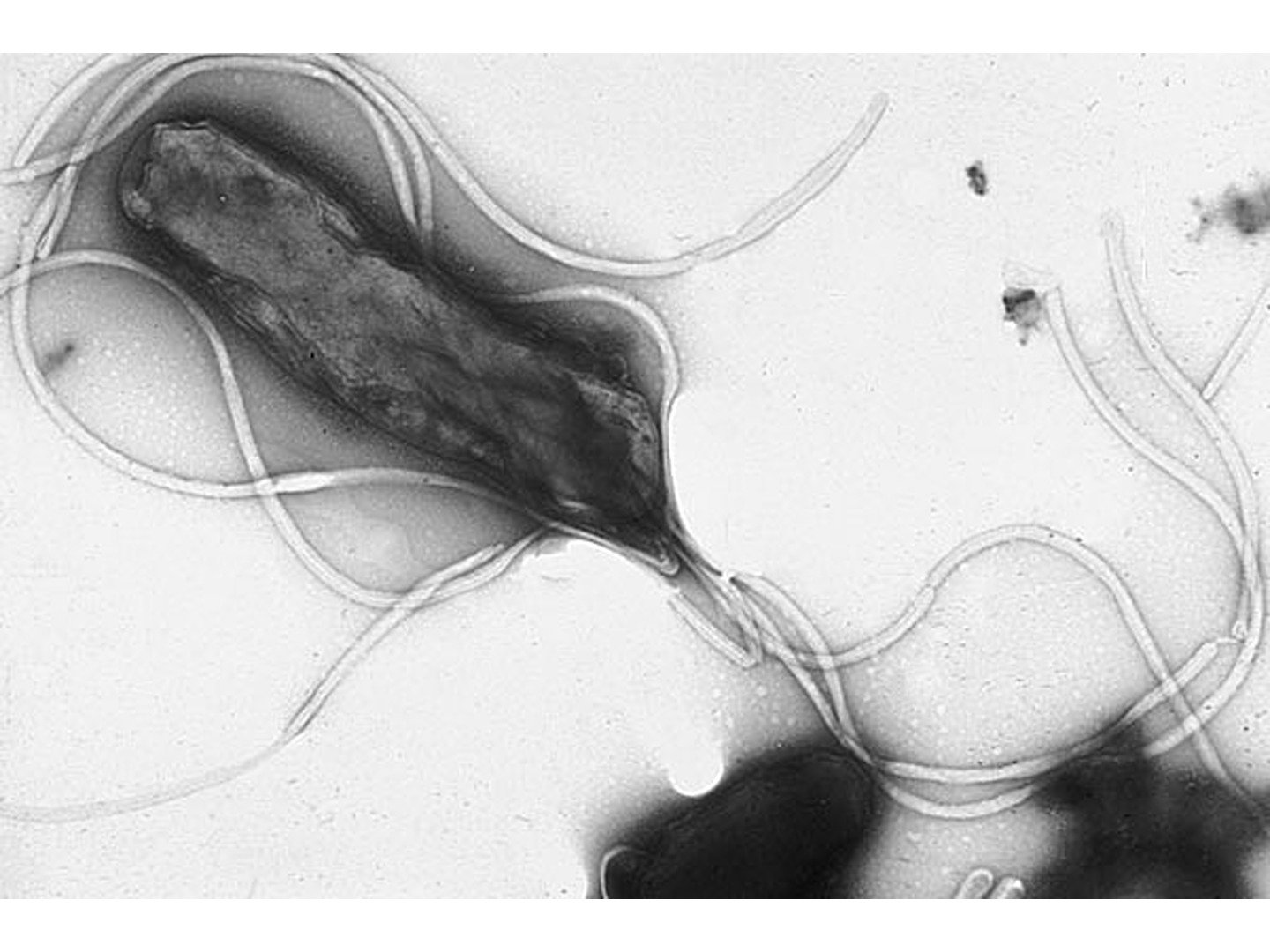 H. Pylori