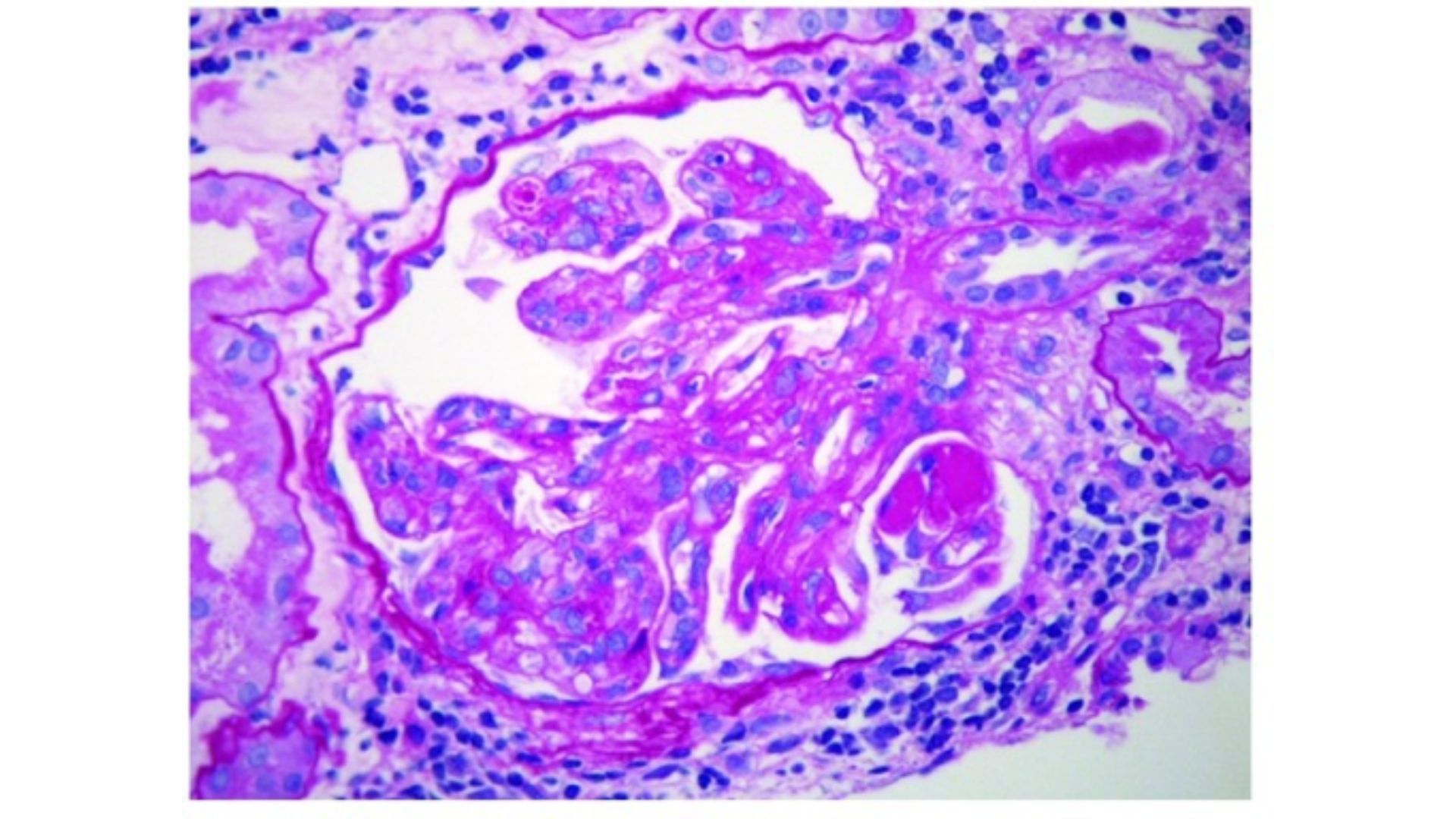 Immunfluoreszenzmikroskopie