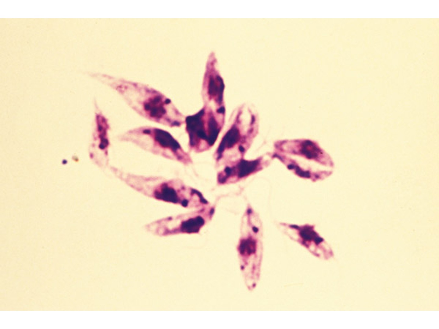 Leishmania tropica Mikroskopie