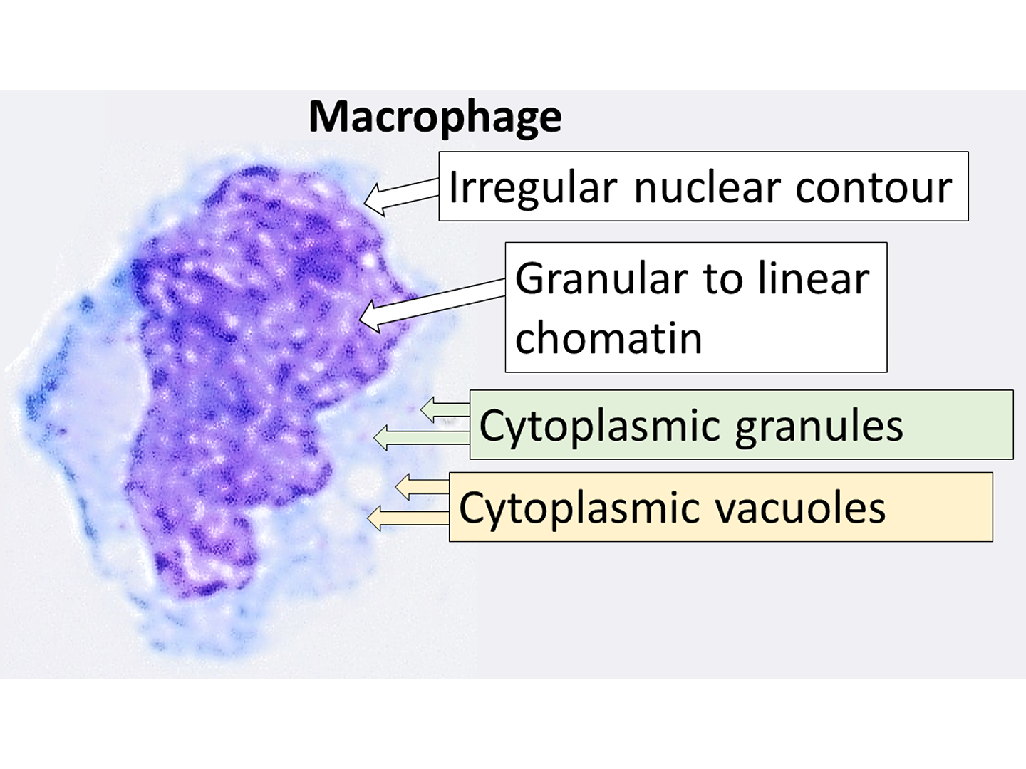 Makrophage