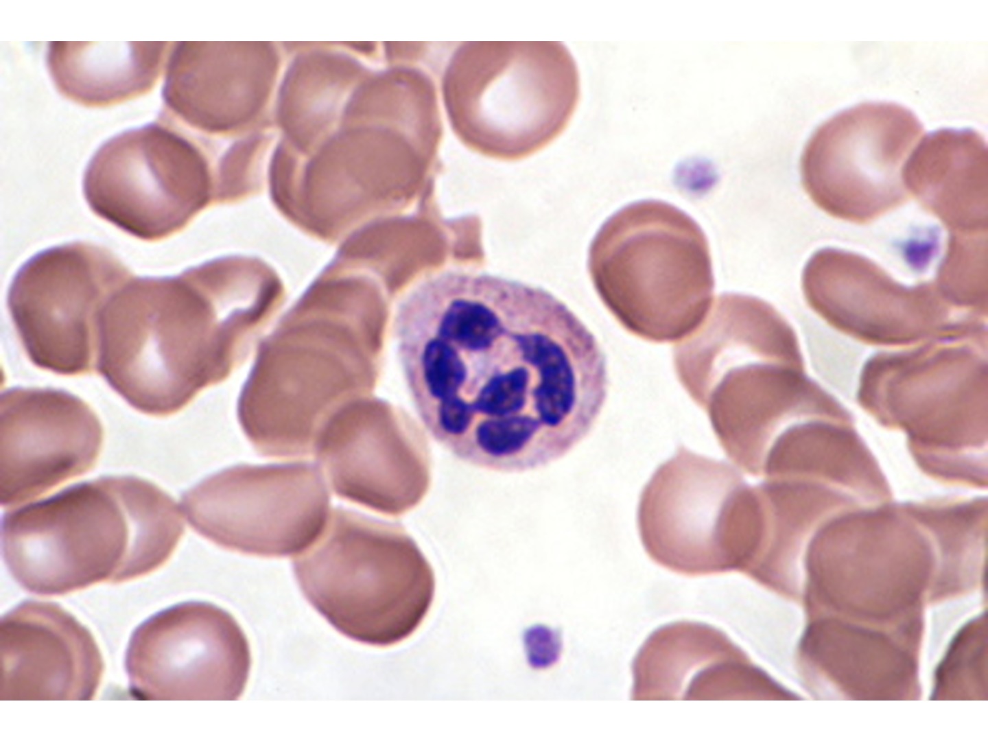 Neutrophiler