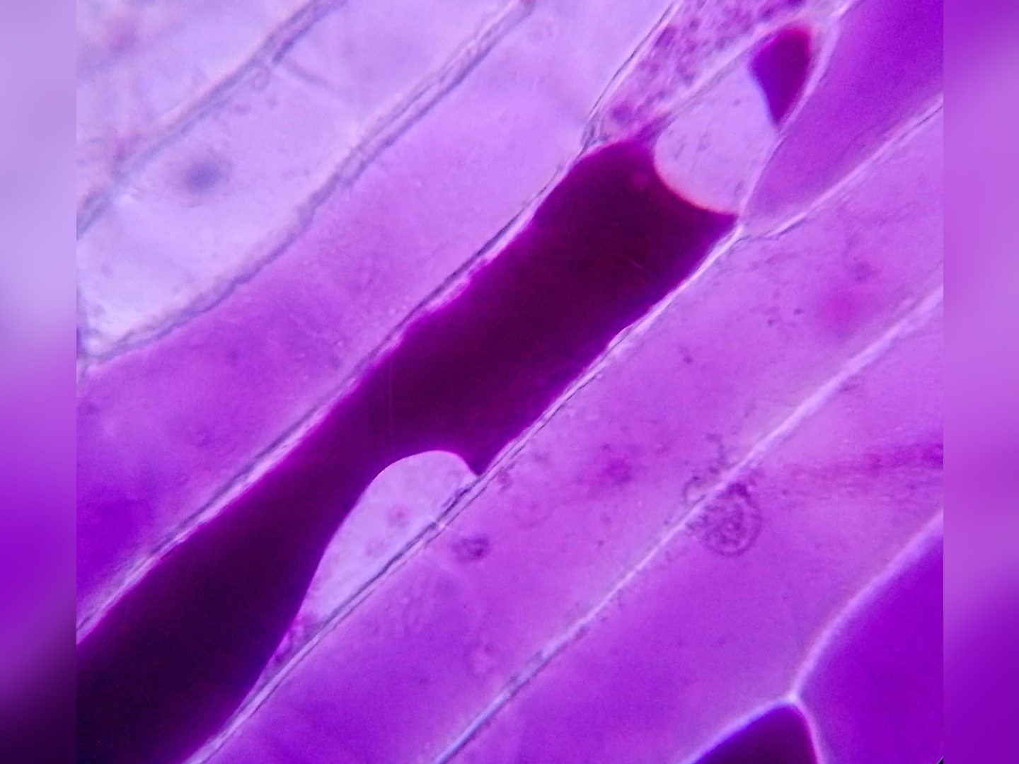 Osmose bei gefärbter Zelle