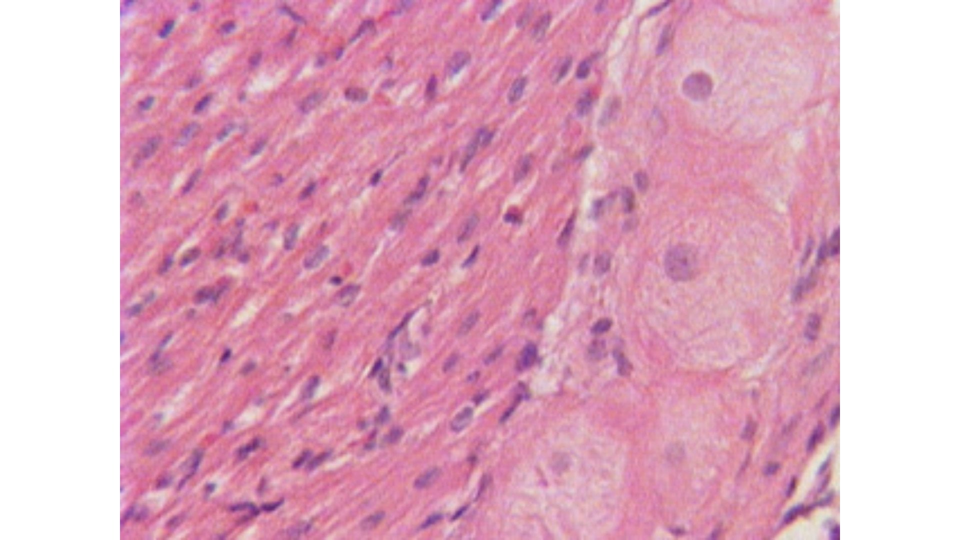 Purkinje-Fasern, Histologie