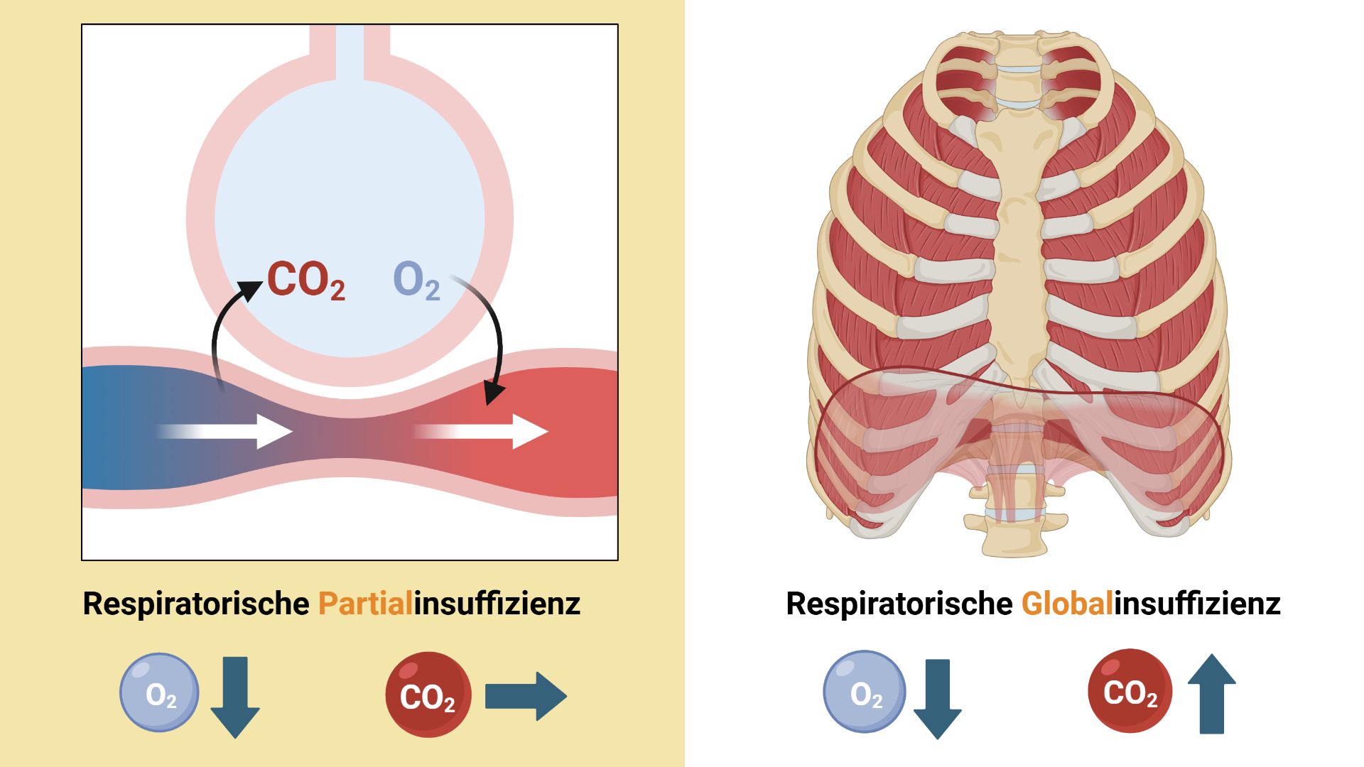 Respiratorische Partial- und Golbalinsuffizienz