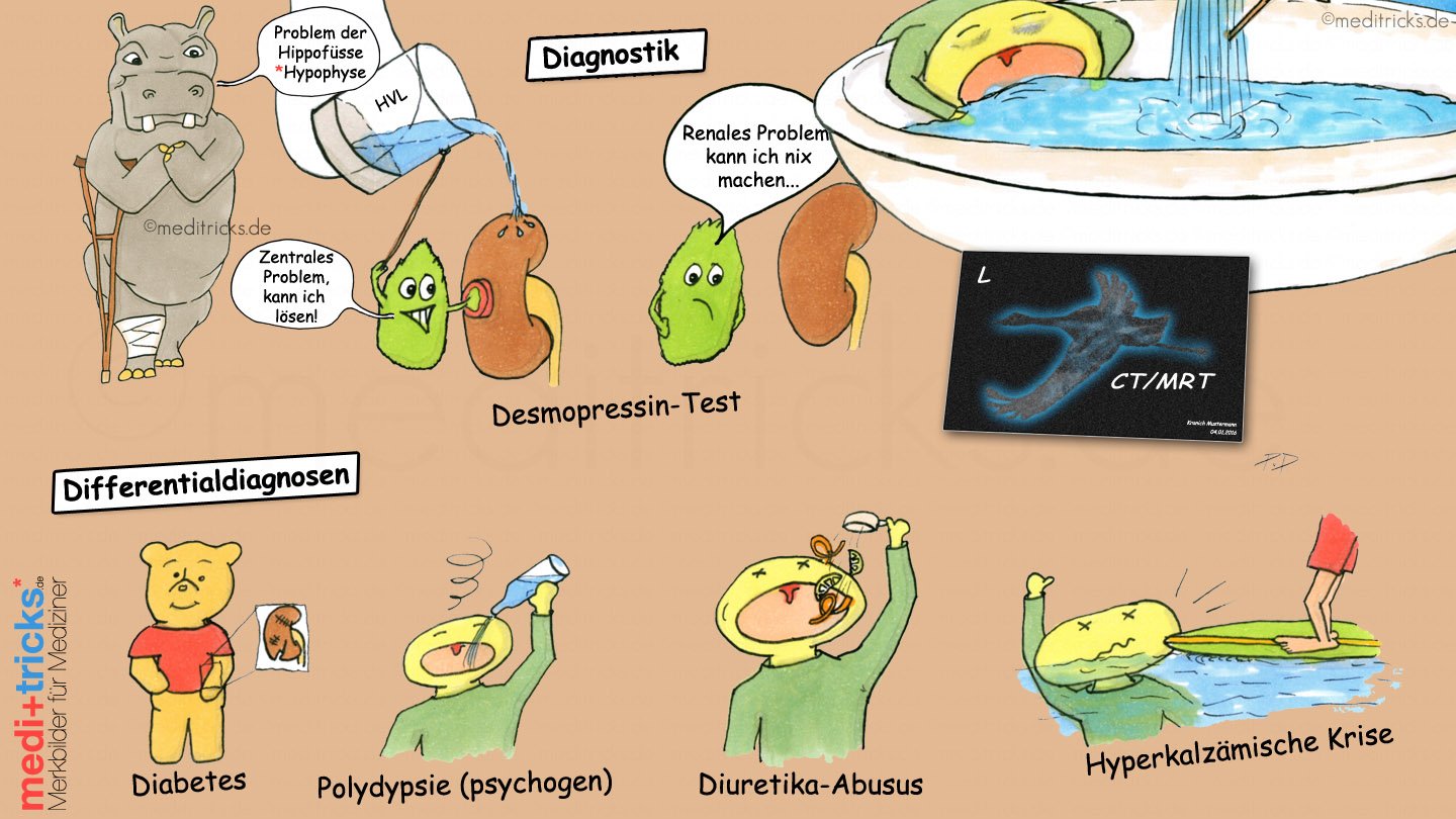 diabetes insipidus centralis ursachen