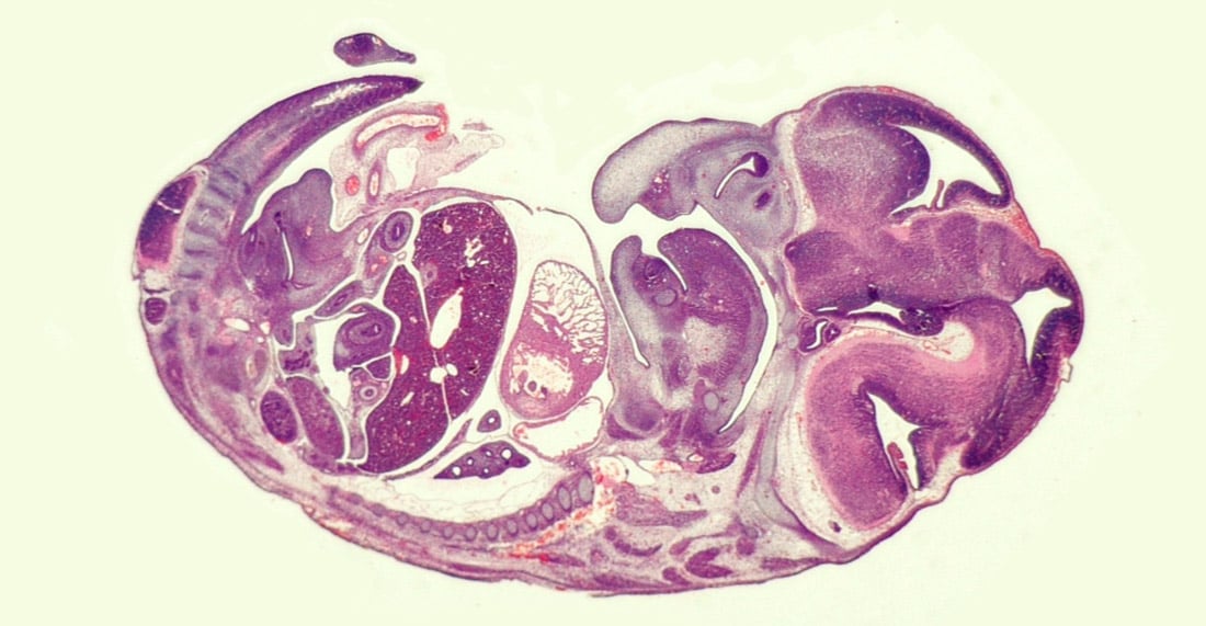 Embryologie lernen mit den Eselsbrücken von Meditricks.de