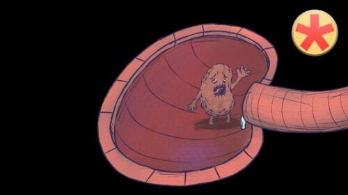 AHT 3: Nierenarterienstenose